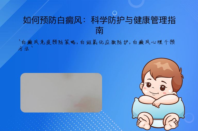 如何预防白癜风：科学防护与健康管理指南