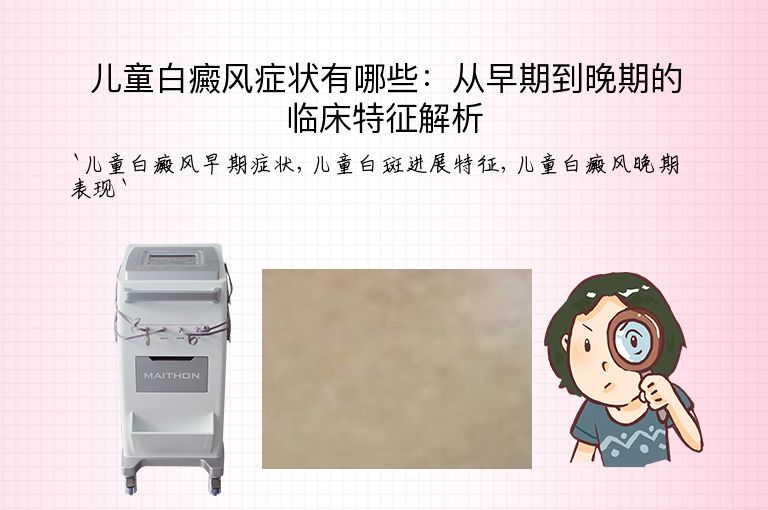 儿童白癜风症状有哪些:从早期到晚期的临床特征解析