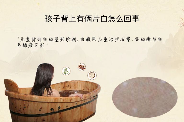 孩子背上有俩片白怎么回事