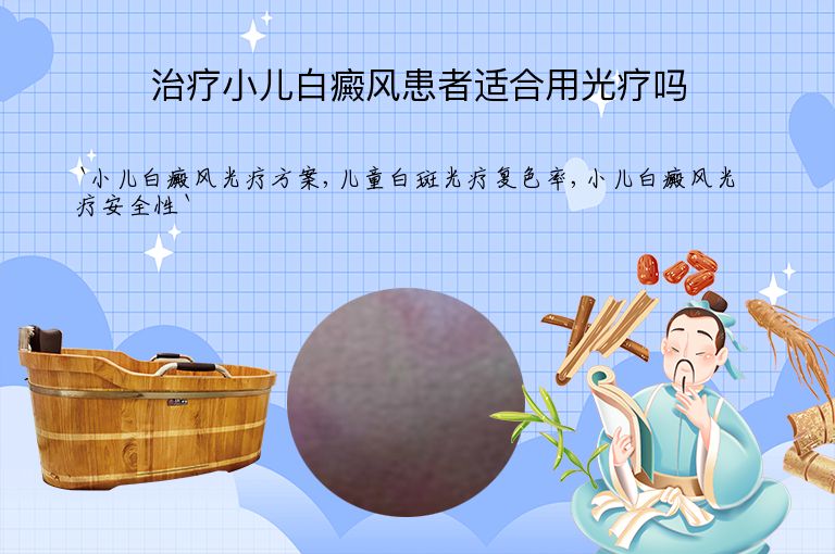 治疗小儿白癜风患者适合用光疗吗