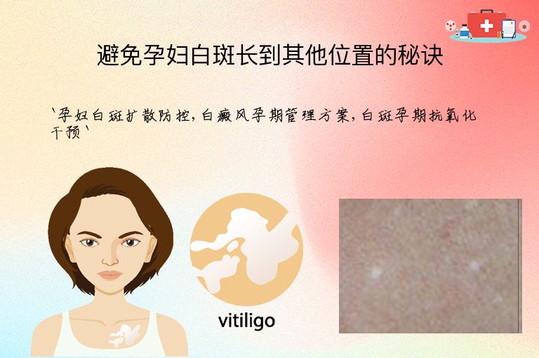 避免孕妇白斑长到其他位置的秘诀