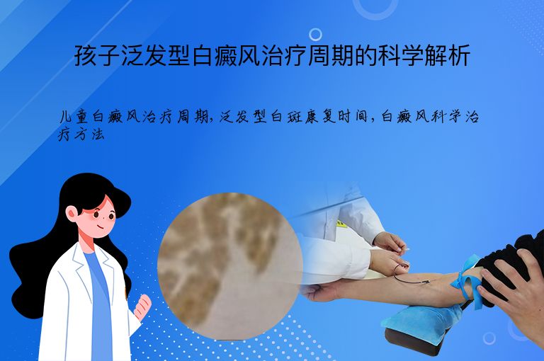 孩子泛发型白癜风治疗周期的科学解析”
