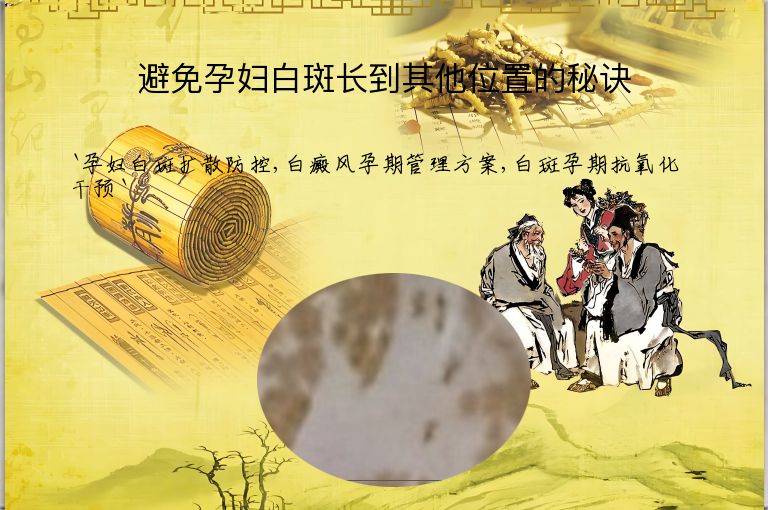 避免孕妇白斑长到其他位置的秘诀