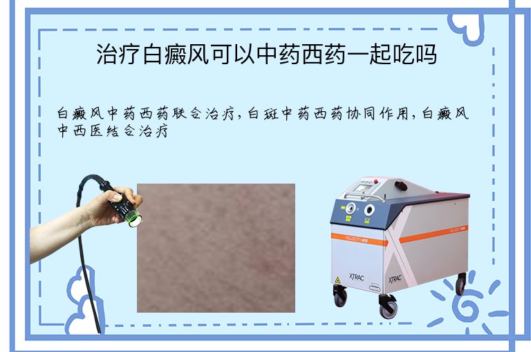 https://www.bdfsjzyy.com/d/file/p/87fb7bae83af56827f23a51c3fa32fe6.jpeg
