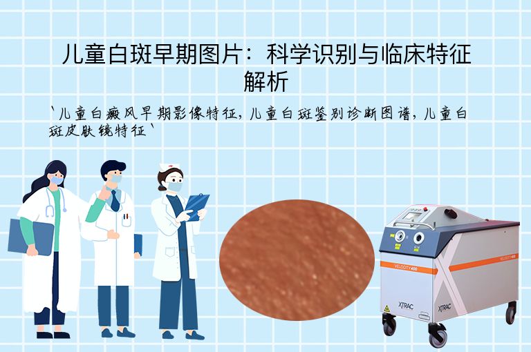 儿童白斑早期图片：科学识别与临床特征解析