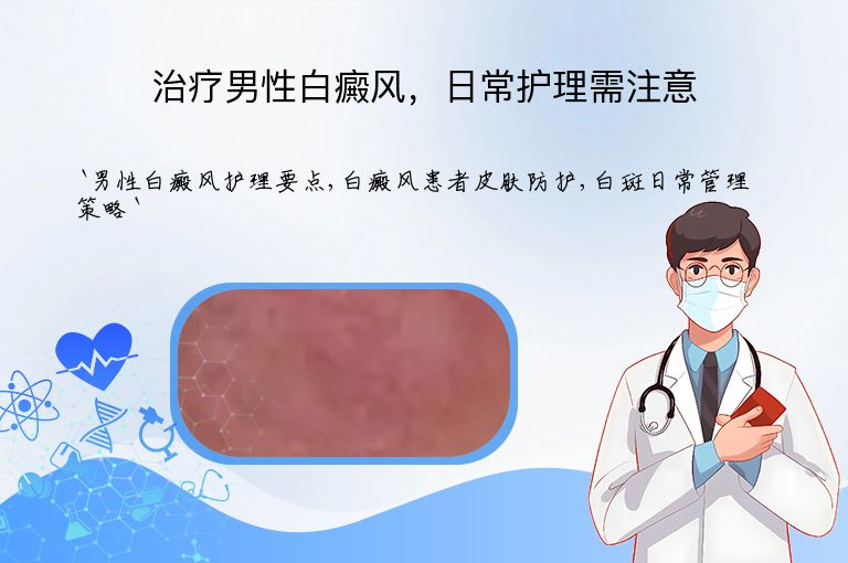 治疗男性白癜风，日常护理需注意
