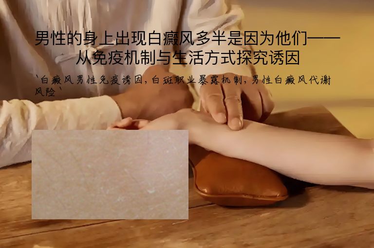 男性的身上出现白癜风多半是因为他们——从免疫机制与生活方式探究诱因