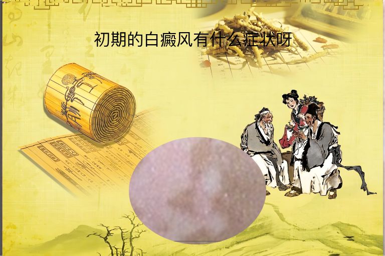 初期的白癜风有什么症状呀