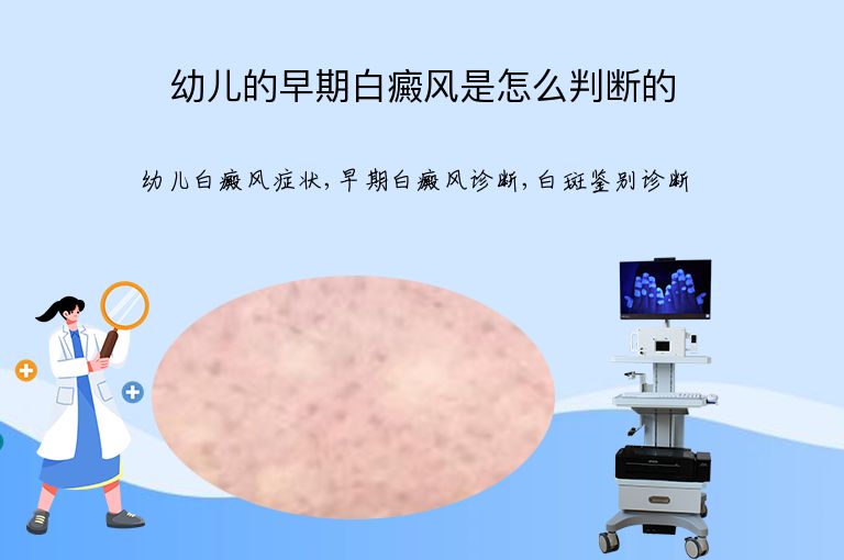 https://www.bdfsjzyy.com/d/file/p/812875ce0200854c4a86c7e2e544e569.jpeg