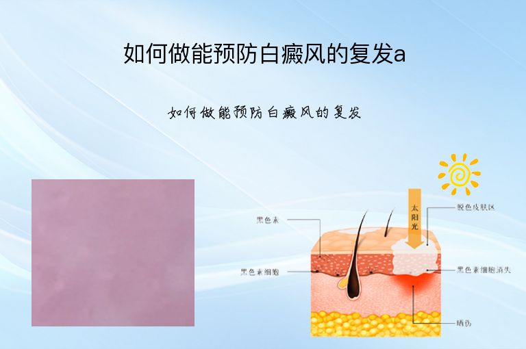 https://www.bdfsjzyy.com/d/file/p/7a2a459f559876b3894af63b864b9bb7.jpeg