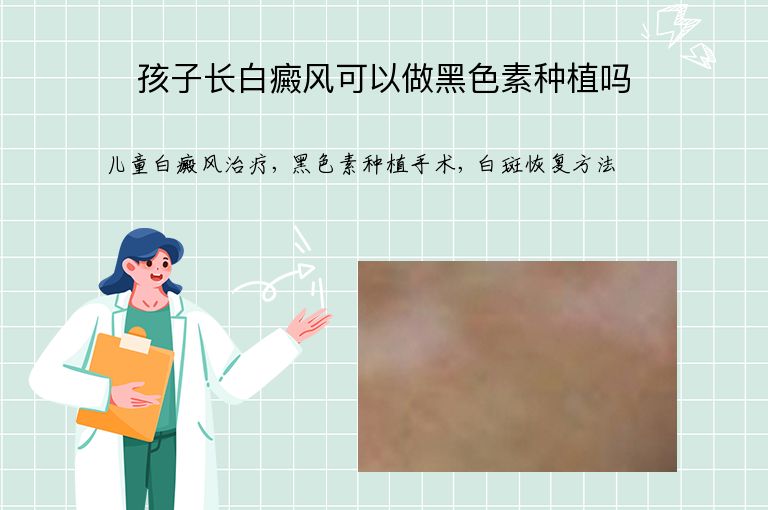 孩子长白癜风可以做黑色素种植吗”