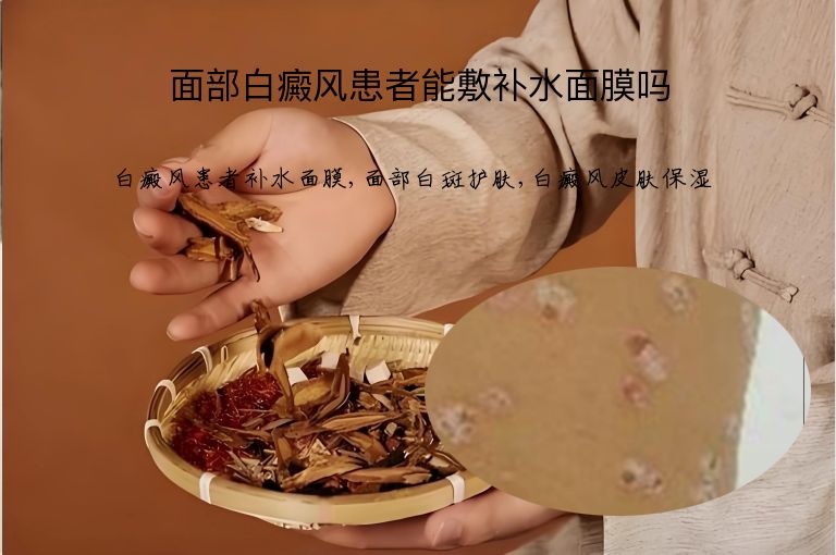 面部白癜风患者能敷补水面膜吗”