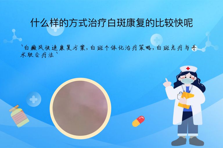 什么样的方式治疗白斑康复的比较快呢