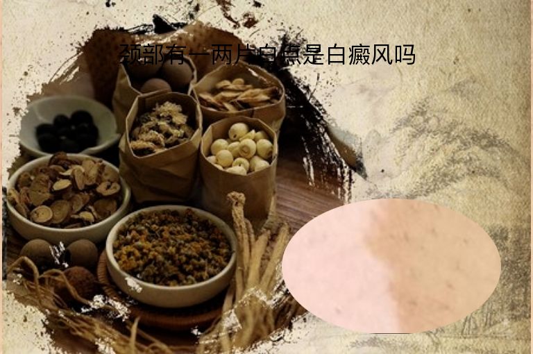 颈部有一两片白点是白癜风吗