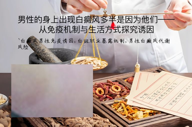 男性的身上出现白癜风多半是因为他们——从免疫机制与生活方式探究诱因