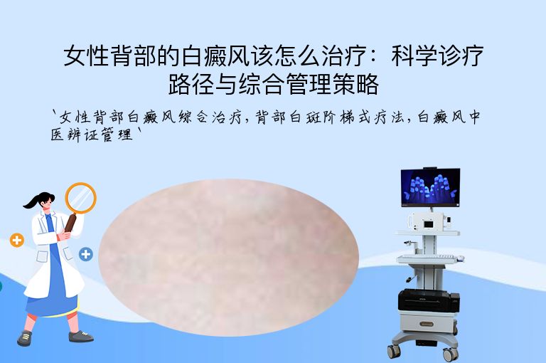女性背部的白癜风该怎么治疗：科学诊疗路径与综合管理策略