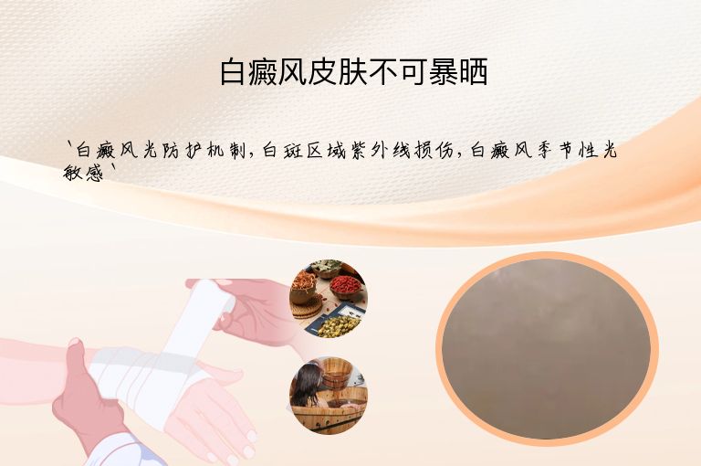 白癜风皮肤不可暴晒