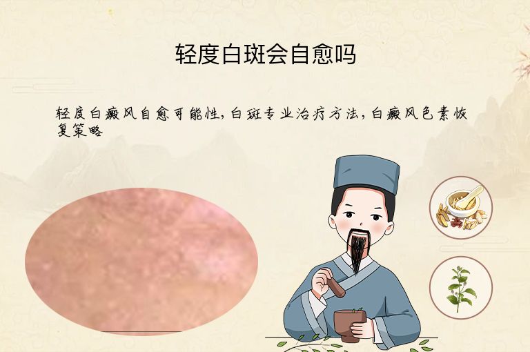 https://www.bdfsjzyy.com/d/file/p/c63d487cef80711bd5ccf4536e739527.jpeg