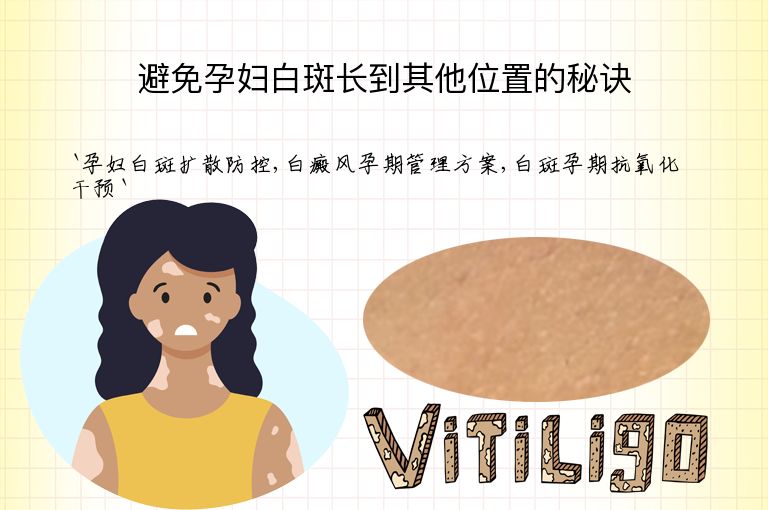 避免孕妇白斑长到其他位置的秘诀