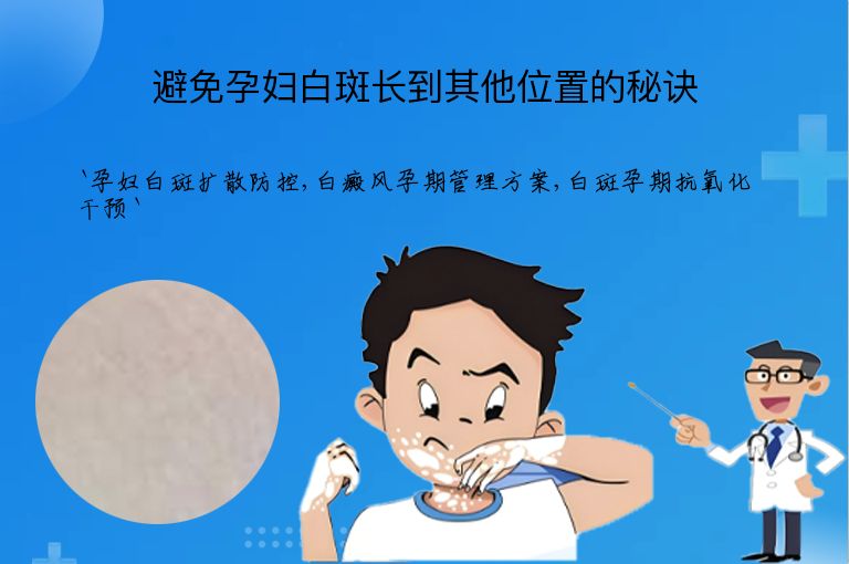 避免孕妇白斑长到其他位置的秘诀