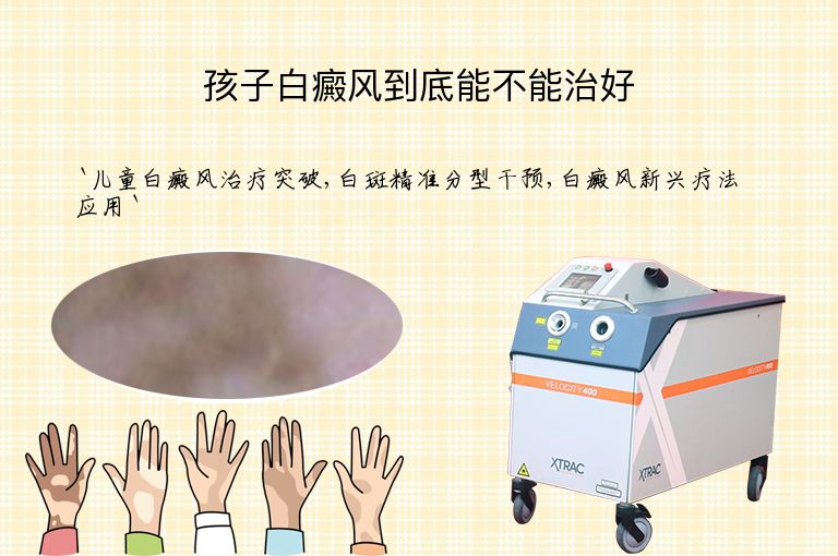孩子白癜风到底能不能治好”