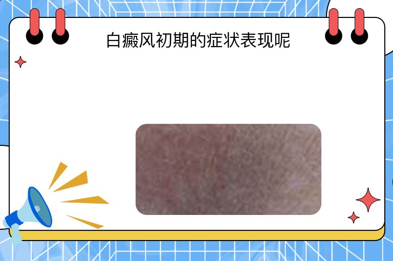 白癜风初期的症状表现呢