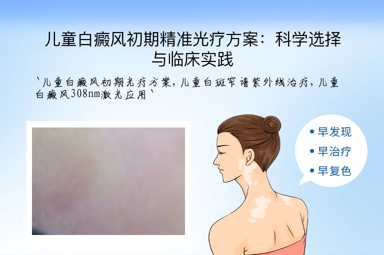 儿童白癜风初期精准光疗方案：科学选择与临床实践