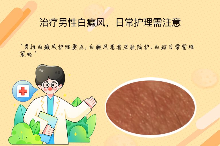 治疗男性白癜风，日常护理需注意
