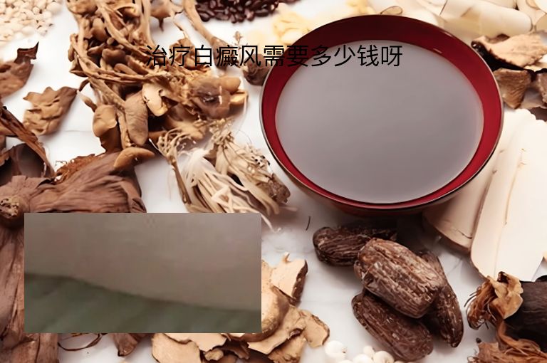 治疗白癜风需要多少钱呀”
