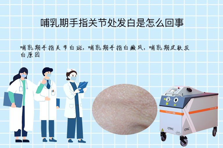 哺乳期手指关节处发白是怎么回事”