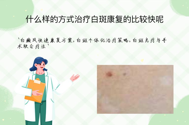 什么样的方式治疗白斑康复的比较快呢