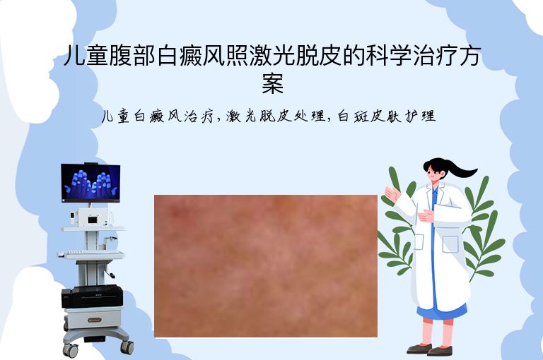 https://www.bdfsjzyy.com/d/file/p/5c130ccf8f5f1b1fe7811d08634611eb.jpeg