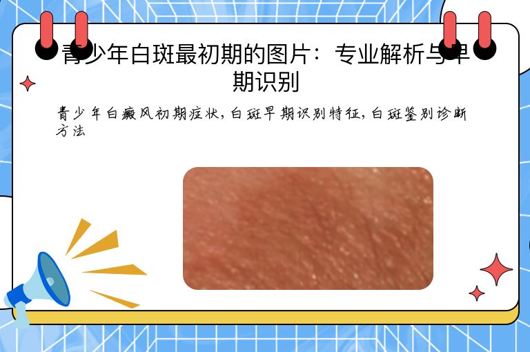 青少年白斑最初期的图片：专业解析与早期识别”