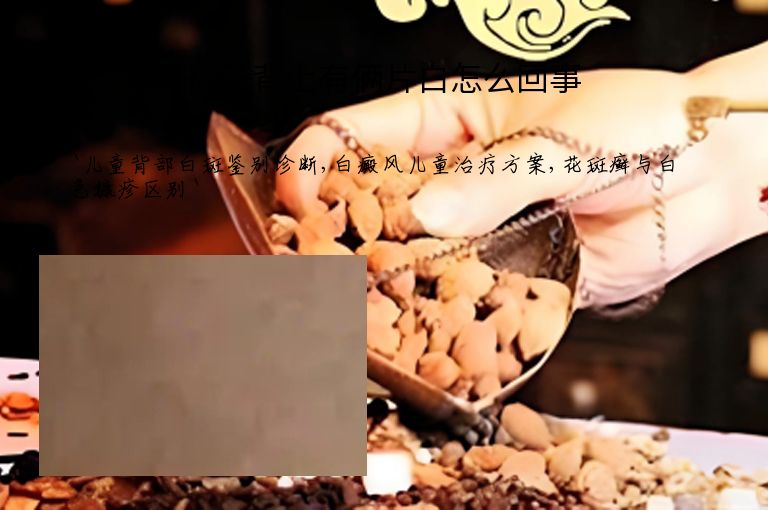 孩子背上有俩片白怎么回事