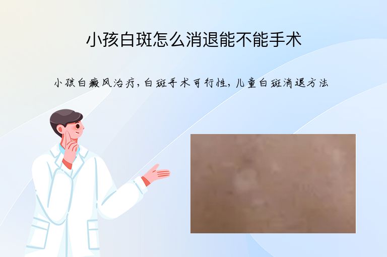 小孩白斑怎么消退能不能手术”