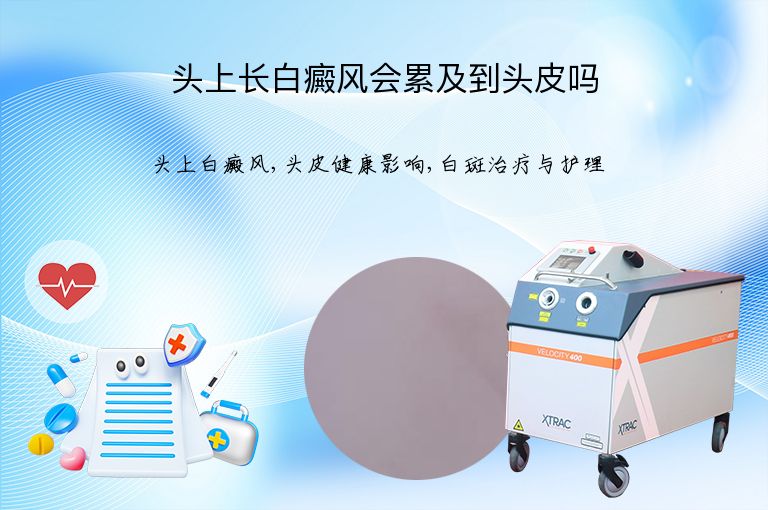 头上长白癜风会累及到头皮吗”