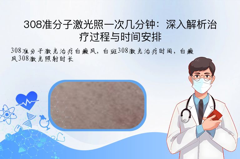 308准分子激光照一次几分钟：深入解析治疗过程与时间安排”