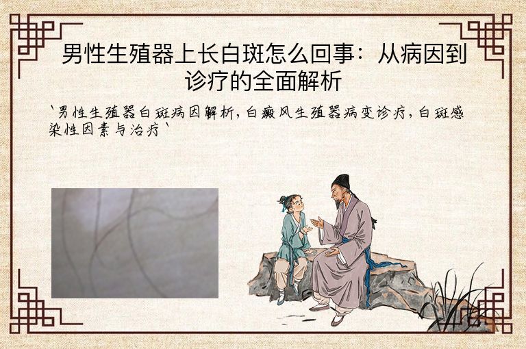 男性生殖器上长白斑怎么回事:从病因到诊疗的全面解析