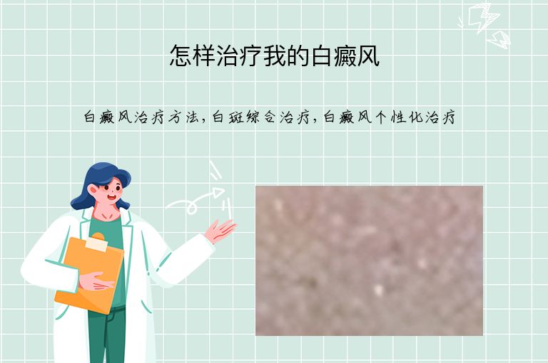 怎样治疗我的白癜风”