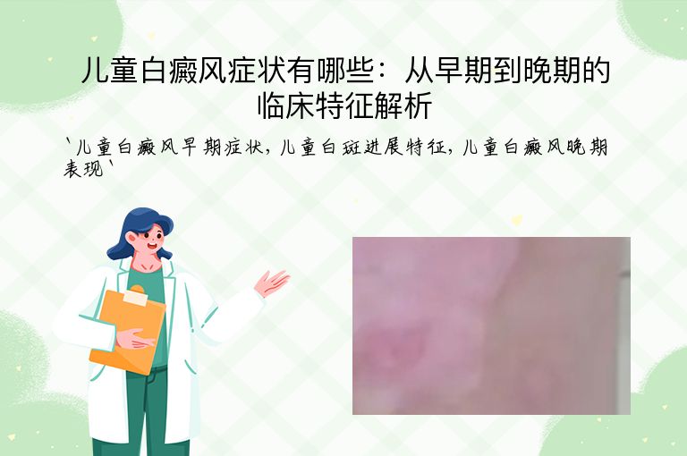 儿童白癜风症状有哪些：从早期到晚期的临床特征解析