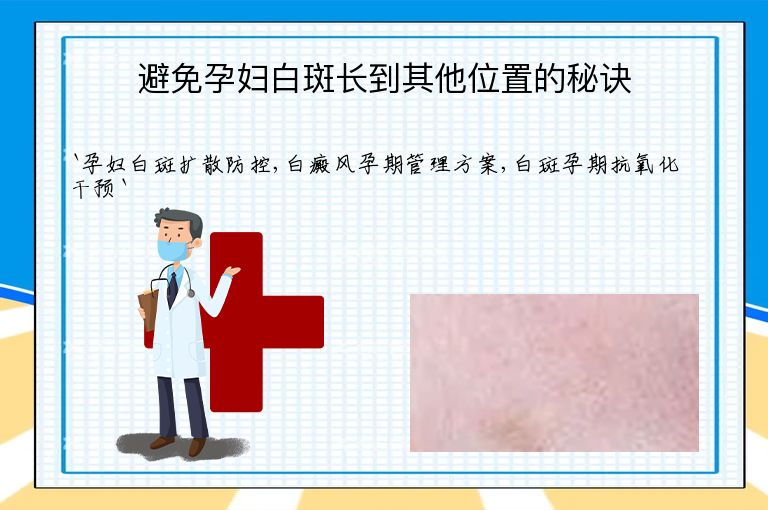避免孕妇白斑长到其他位置的秘诀
