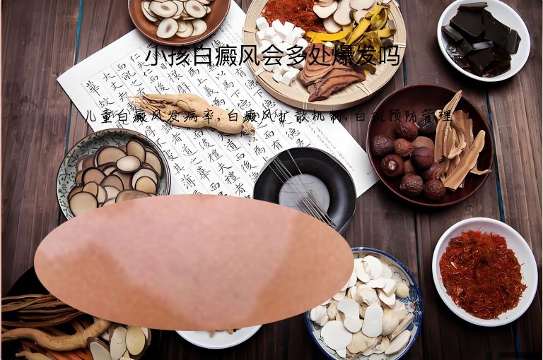 小孩白癜风会多处爆发吗”