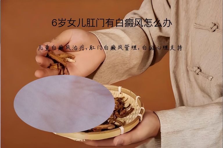 6岁女儿肛门有白癜风怎么办”