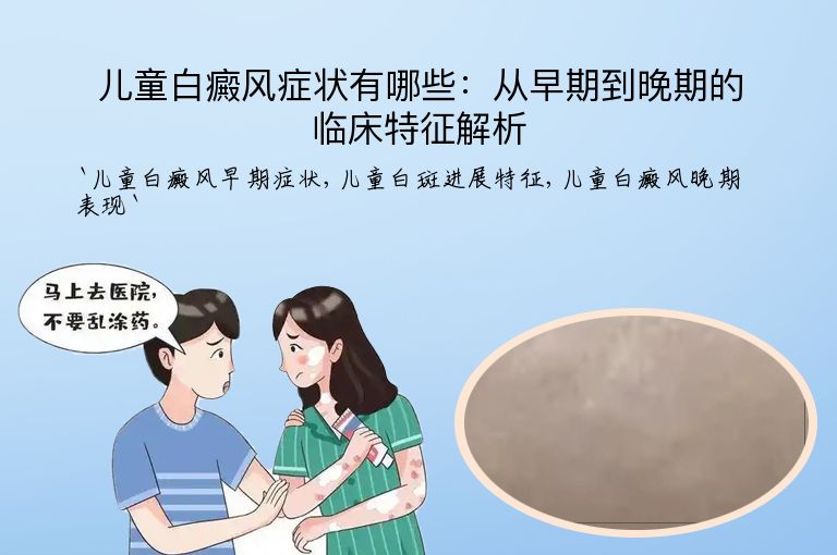 儿童白癜风症状有哪些:从早期到晚期的临床特征解析