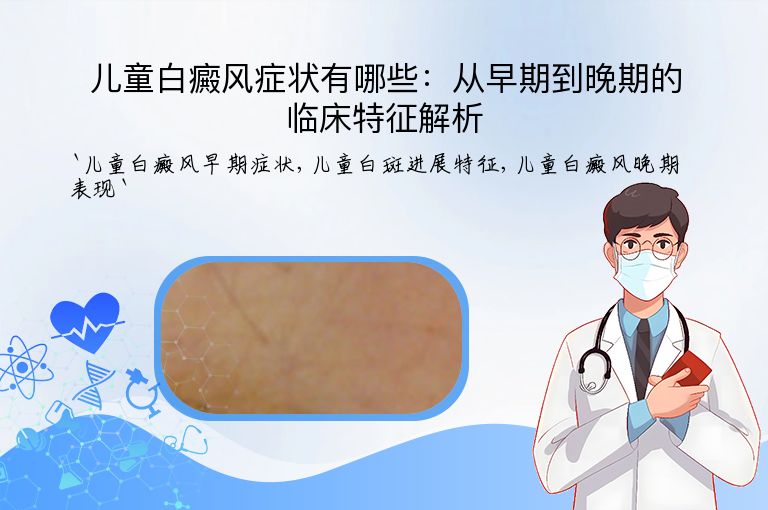 儿童白癜风症状有哪些:从早期到晚期的临床特征解析