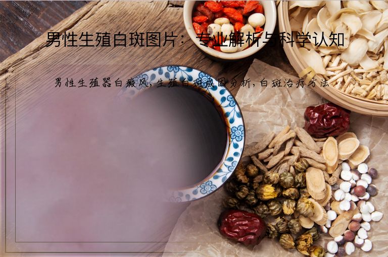 男性生殖白斑图片：专业解析与科学认知”
