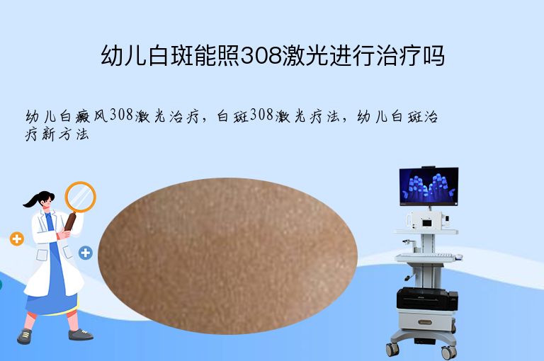 幼儿白斑能照308激光进行治疗吗”