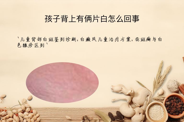 孩子背上有俩片白怎么回事