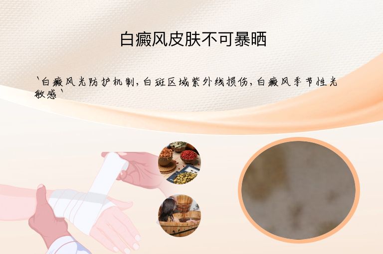 白癜风皮肤不可暴晒