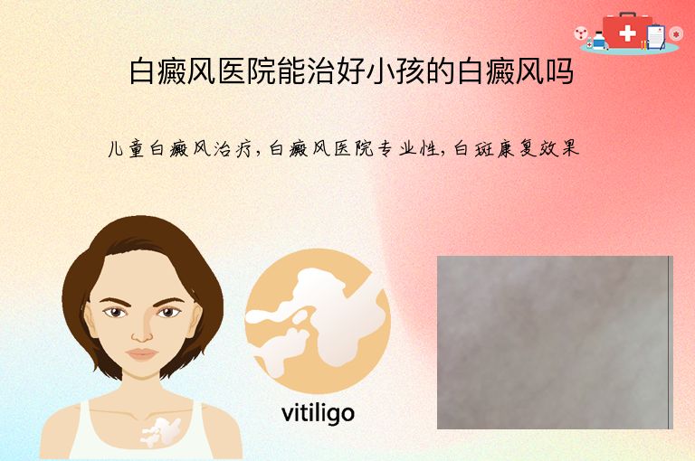 白癜风医院能治好小孩的白癜风吗”